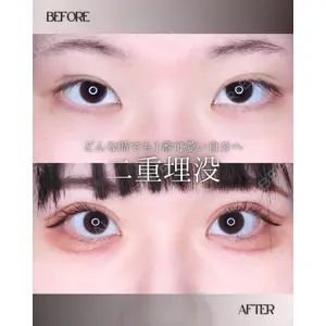 小倉美容外科/美容皮膚科 ビラビューティークリニック 大村 亞蘭医師の症例
