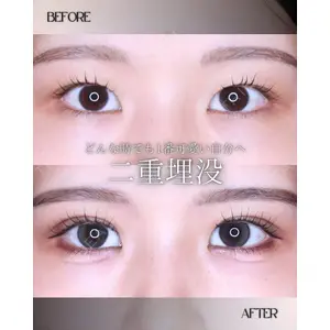 小倉美容外科/美容皮膚科 ビラビューティークリニック 大村 亞蘭医師の症例