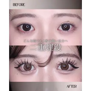 小倉美容外科/美容皮膚科 ビラビューティークリニック 大村 亞蘭医師の症例