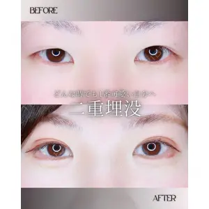 小倉美容外科/美容皮膚科 ビラビューティークリニック 大村 亞蘭医師の症例