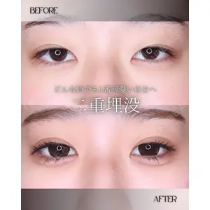 小倉美容外科/美容皮膚科 ビラビューティークリニック 大村 亞蘭医師の症例