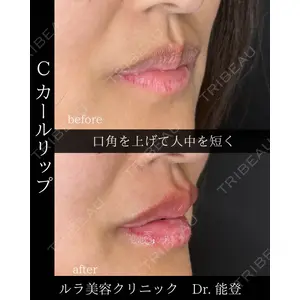 ルラ美容クリニック 新潟院 能登 貴弘医師の症例
