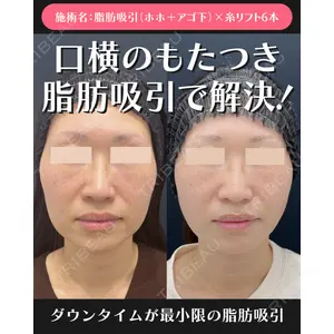 湘南美容クリニック 川崎院 伊藤 賀敏医師の症例