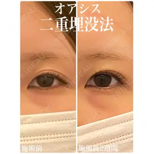 オアシス美容外科 遠藤 剛史医師の症例