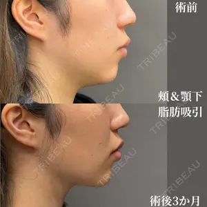 吉井クリニック 吉井 健吾医師の症例