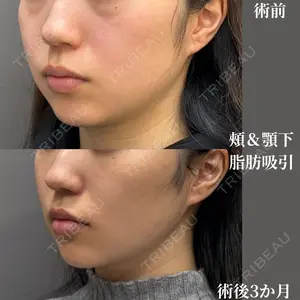 吉井クリニック 吉井 健吾医師の症例