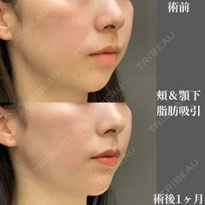 吉井クリニック 吉井 健吾医師の症例