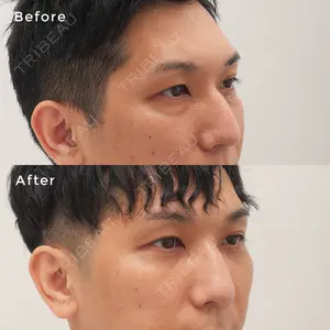 東京イセアクリニック 酒井 新介医師の症例