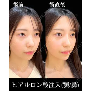 HAAB×DREAM BEAUTY CLINIC 東京本院 佐野 圭医師の症例