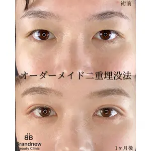Brandnew Beauty Clinic 平山 容成医師の症例
