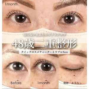 湘南美容クリニック 大阪梅田院 横谷 仁彦医師の症例