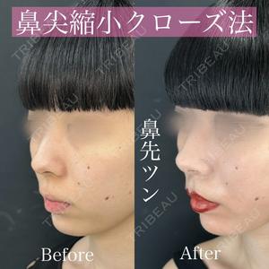 ルラ美容クリニック 渋谷本院 昼間 路子医師の症例