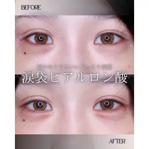 小倉美容外科/美容皮膚科 ビラビューティークリニック 大村 亞蘭医師の症例