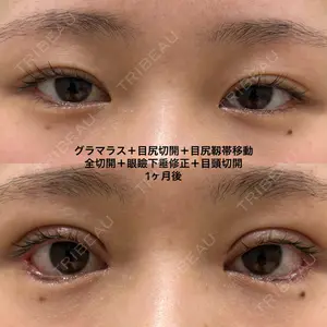 エターナル美容クリニック 久門田 詳医師の症例
