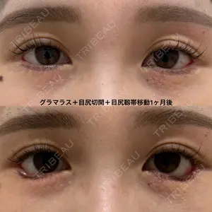 エターナル美容クリニック 久門田 詳医師の症例