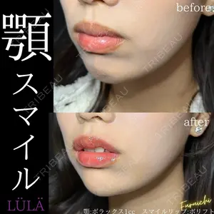 ルラ美容クリニック 新宿院 古市 まり江医師の症例