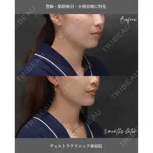 ヴェルトラクリニック 大阪院の症例