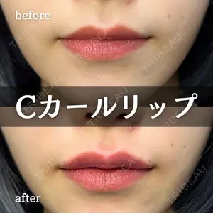 ルラ美容クリニック 新宿院 陶 美梨医師の症例