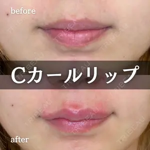 ルラ美容クリニック 新宿院 陶 美梨医師の症例