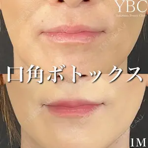 YBC横浜美容外科 池袋院 磯村 亮輔医師の症例