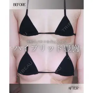 小倉美容外科/美容皮膚科 ビラビューティークリニック 大村 亞蘭医師の症例