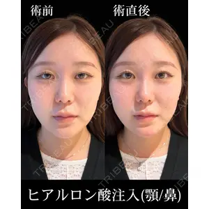 HAAB×DREAM BEAUTY CLINIC 東京本院 佐野 圭医師の症例