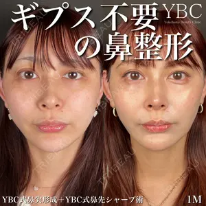 YBC横浜美容外科 池袋院 磯村 亮輔医師の症例