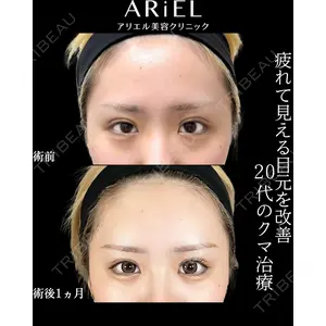アリエル美容クリニック 横浜院 渡邉 光医師の症例