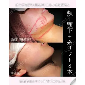 ヴェルトラクリニック 新宿院 伊藤　優医師の症例