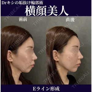ネビュラクリニック 京都院 岸 大輔医師の症例