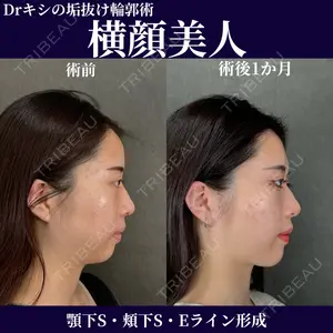 ネビュラクリニック 京都院 岸 大輔医師の症例