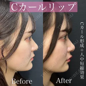 ルラ美容クリニック 渋谷本院 昼間 路子医師の症例