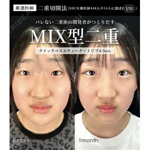 湘南美容クリニック 大阪梅田院 横谷 仁彦医師の症例
