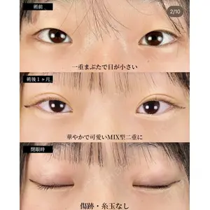 湘南美容クリニック 大阪梅田院 横谷 仁彦医師の症例
