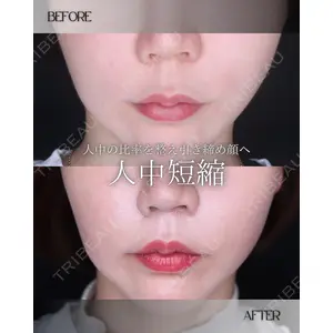 小倉美容外科/美容皮膚科 ビラビューティークリニック 大村 亞蘭医師の症例