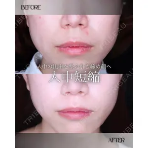 小倉美容外科/美容皮膚科 ビラビューティークリニック 大村 亞蘭医師の症例
