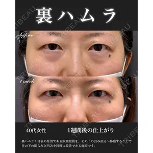 EMMO FACE CLINIC 大宮院 百瀬 直也医師の症例