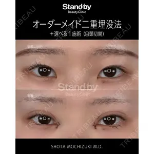 Stand by Beauty Clinic 望月 聖太医師の症例
