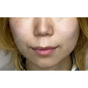 Original Beauty Clinic GINZA 佐藤玲史医師の症例
