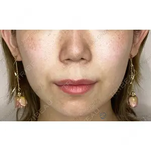 Original Beauty Clinic GINZA 佐藤玲史医師の症例