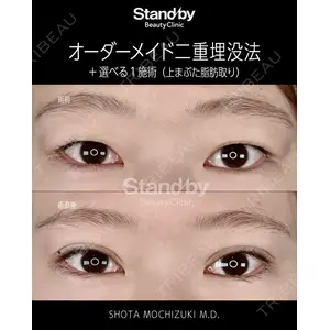 Stand by Beauty Clinic 望月 聖太医師の症例