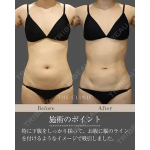 THE CLINIC（ザ・クリニック） 名古屋院 加藤 和樹医師の症例