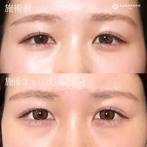 東京形成美容外科 船橋院 弓削田　浩主医師の症例