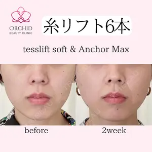 オーキッド美容クリニック東京御徒町 西浦 蘭子医師の症例