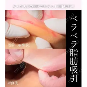 ヴェルトラクリニック 新宿院 伊藤　優医師の症例