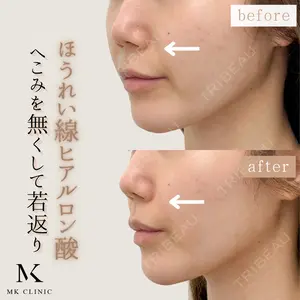 MKクリニック 日本橋院の症例