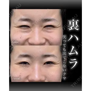EMMO FACE CLINIC 大宮院 百瀬 直也医師の症例