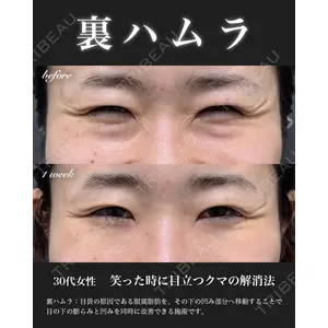 EMMO FACE CLINIC 大宮院 百瀬 直也医師の症例