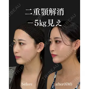 EMMO FACE CLINIC 大阪梅田院 神谷 一成医師の症例