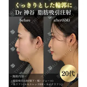 EMMO FACE CLINIC 大阪梅田院 神谷 一成医師の症例